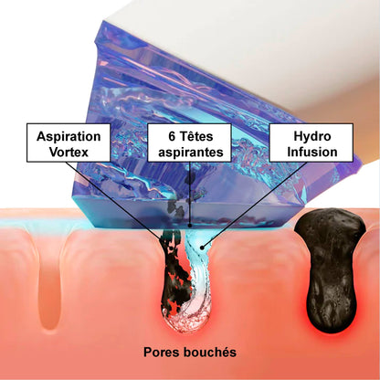 Dispositif Hydrafacial portable - Launchify